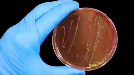 Escherichia coli e sua relação com as doenças respiratórias