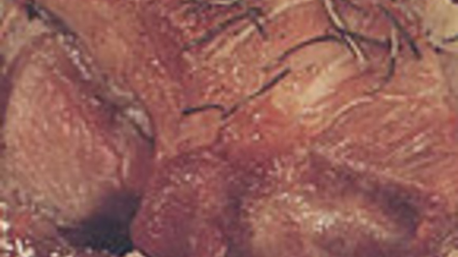 Lombo Suíno Trançado com Bacon e Abacaxi - Chef J. S. Motta