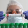 Estudo científico indica potencial de expansão do vírus H5N1 da Gripe Aviária