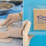 Curativo de pele de tilápia da Universidade Federal do Ceará chega ao mercado: inovação licenciada para produção em larga escala