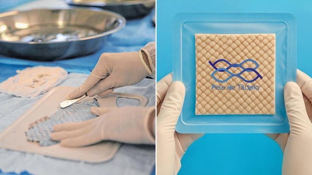 Curativo de pele de tilápia da Universidade Federal do Ceará chega ao mercado: inovação licenciada para produção em larga escala Curativo de pele de tilápia da Universidade Federal do Ceará chega ao mercado: inovação licenciada para produção em larga escala